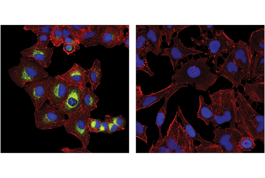 Immunofluorescence Image 1: MUC5AC (E3O9I) XP® Rabbit mAb (BSA and Azide Free)