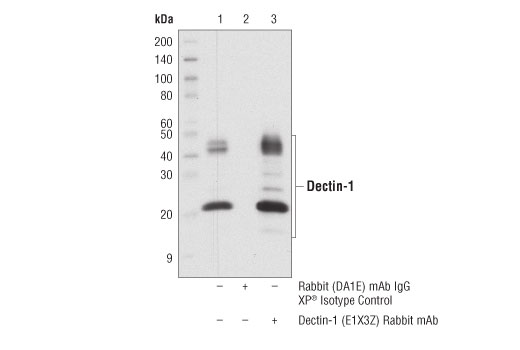 Immunoprecipitation Image 1: Dectin-1 (E1X3Z) Rabbit mAb