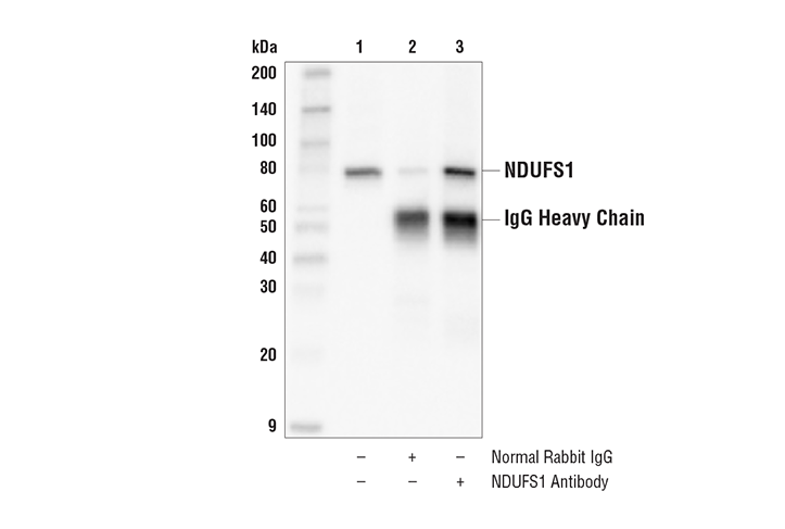 Immunoprecipitation Image 1: NDUFS1 Antibody
