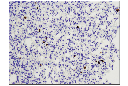 Immunohistochemistry Image 1: CD8α (D4W2Z) XP® Rabbit mAb (Mouse Specific) (BSA and Azide Free)