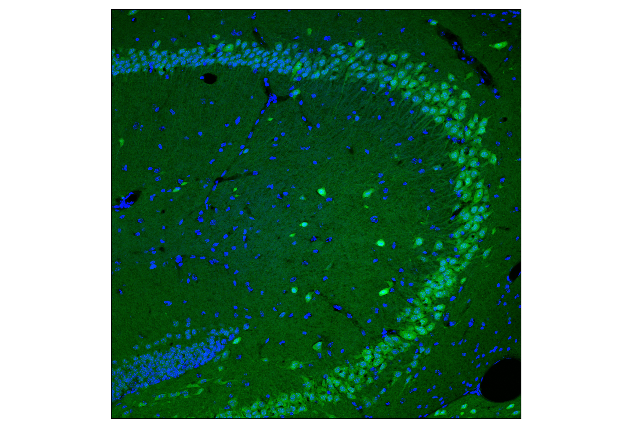 Immunofluorescence Image 2: CRBN (F4I7F) Rabbit mAb