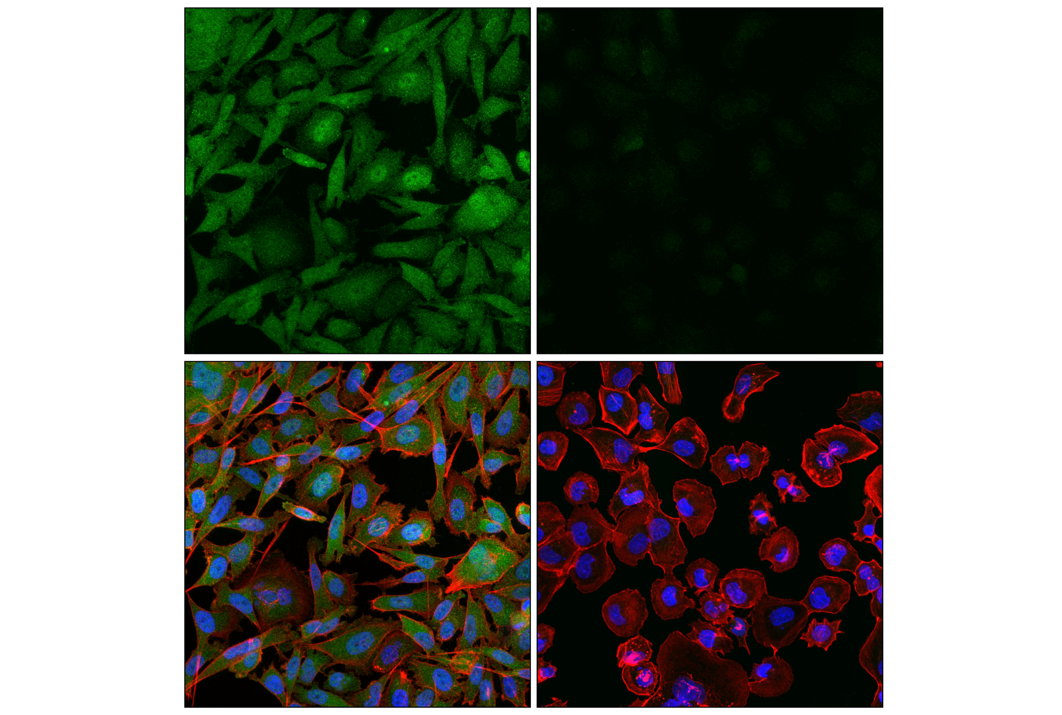 Immunofluorescence Image 3: CRBN (F4I7F) Rabbit mAb