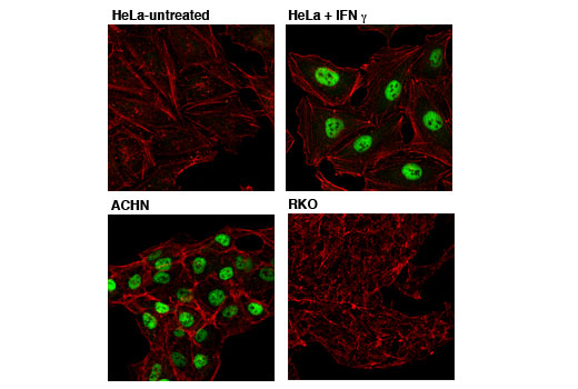 Immunofluorescence Image 1: PSMB8/LMP7 (1A5) Mouse mAb (BSA and Azide Free)