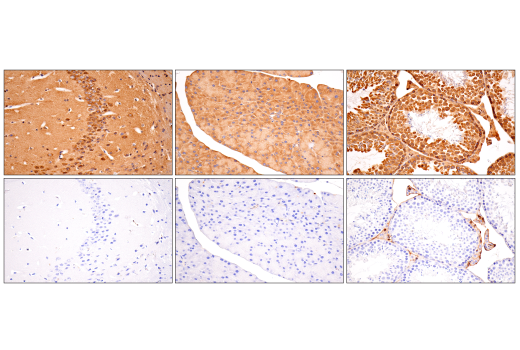 Immunohistochemistry Image 9: B-Raf (E3T5C) Mouse mAb (BSA and Azide Free)