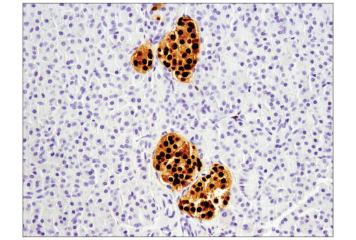  Image 34: Pancreatic Marker IHC Antibody Sampler Kit