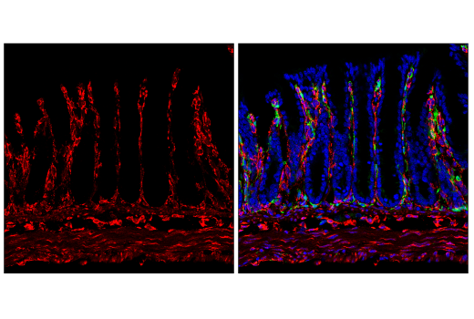 Immunofluorescence Image 1: HSP47/SERPINH1 (E9Y8E) Rabbit mAb