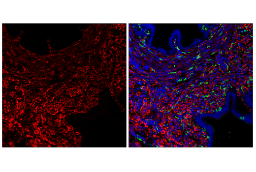 Immunofluorescence Image 2: HSP47/SERPINH1 (E9Y8E) Rabbit mAb