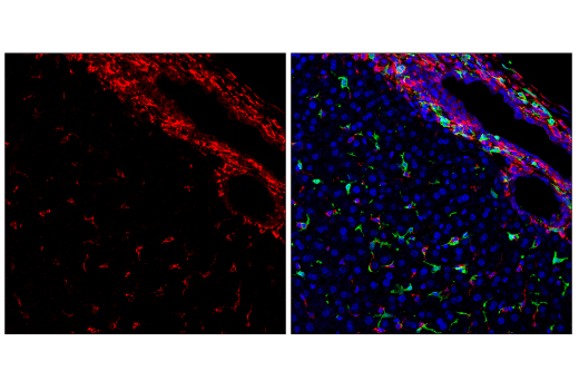 Immunofluorescence Image 3: HSP47/SERPINH1 (E9Y8E) Rabbit mAb