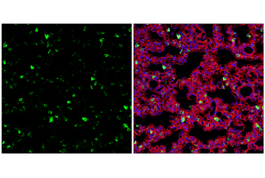 Immunofluorescence Image 2: Lysozyme C-1/2 (E2K5R) XP® Rabbit mAb