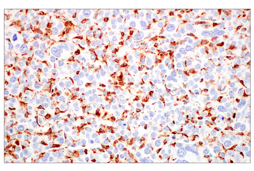 Immunohistochemistry Image 1: Lysozyme C-1/2 (E2K5R) XP® Rabbit mAb