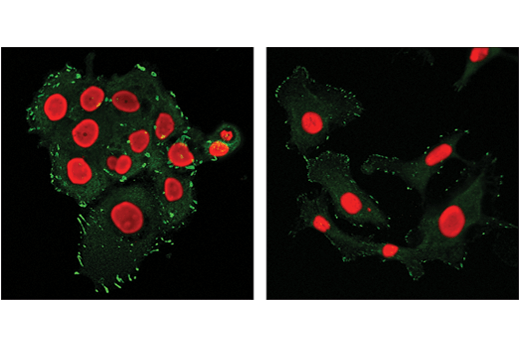 Immunofluorescence Image 1: FAK (D5O7U) XP® Rabbit mAb (BSA and Azide Free)