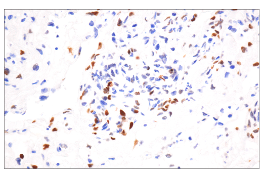 Immunohistochemistry Image 1: Phospho-Histone H2A.X (Ser139) (20E3) Rabbit mAb (BSA and Azide Free)