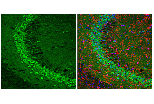 Immunofluorescence Image 1: UCHL1 (E6B8E) Mouse mAb
