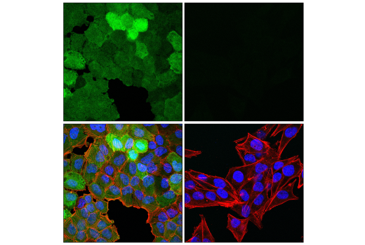 Immunofluorescence Image 2: UCHL1 (E6B8E) Mouse mAb