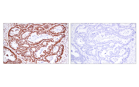 Immunohistochemistry Image 2: 53BP1 (E7N5D) XP® Rabbit mAb (BSA and Azide Free)