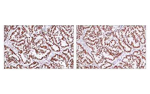 Immunohistochemistry Image 1: 53BP1 (E7N5D) XP® Rabbit mAb (BSA and Azide Free)