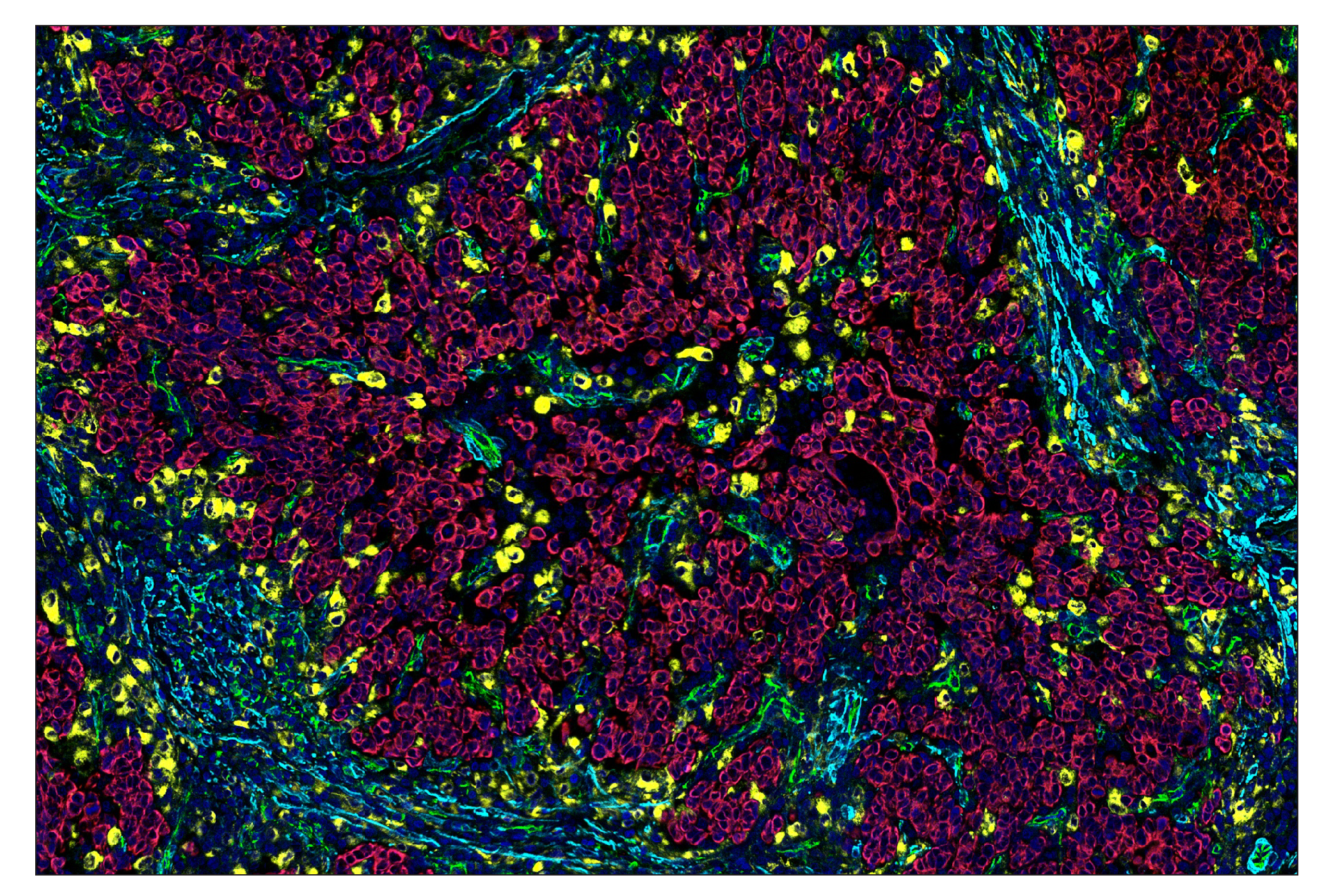 Immunohistochemistry Image 7: CD68 (D4B9C) & CO-0007-488 SignalStar™ Oligo-Antibody Pair