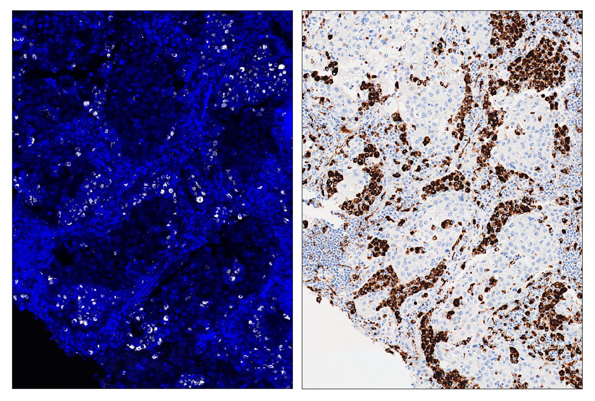 Immunohistochemistry Image 6: CD68 (D4B9C) & CO-0007-488 SignalStar™ Oligo-Antibody Pair