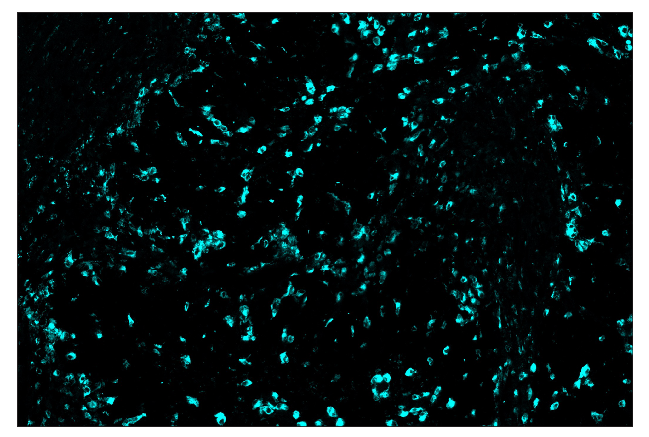 Immunohistochemistry Image 5: CD68 (D4B9C) & CO-0007-488 SignalStar™ Oligo-Antibody Pair
