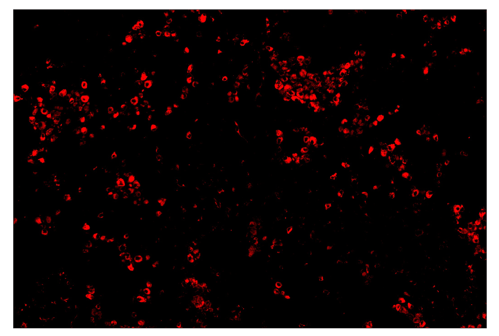 Immunohistochemistry Image 4: CD68 (D4B9C) & CO-0007-750 SignalStar™ Oligo-Antibody Pair