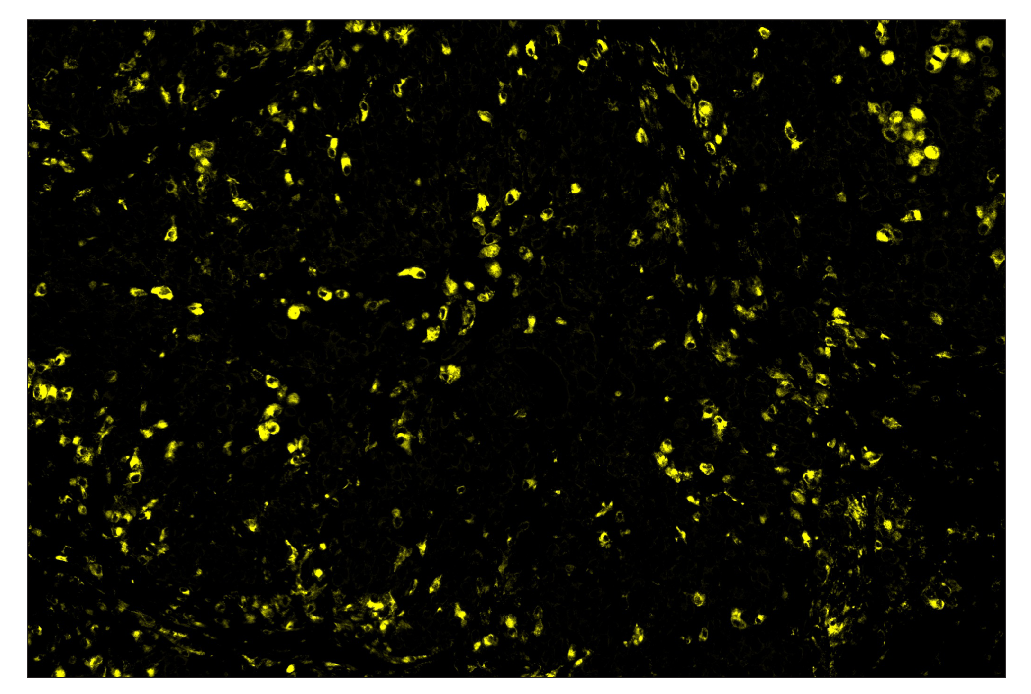 Immunohistochemistry Image 3: CD68 (D4B9C) & CO-0007-488 SignalStar™ Oligo-Antibody Pair