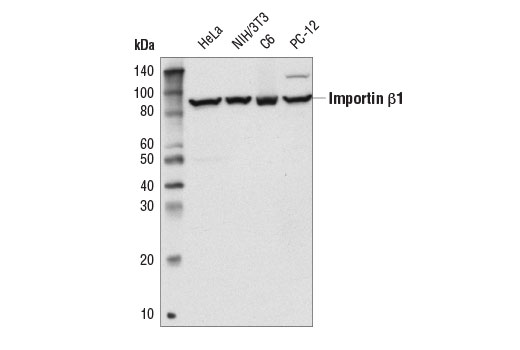 Western Blotting Image 1: Importin β1 (E1F1G) Rabbit mAb