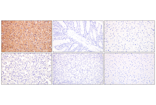 Immunohistochemistry Image 1: UCP1 (E9Z2V) XP® Rabbit mAb (BSA and Azide Free)