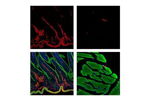 Immunofluorescence Image 1: α-Smooth Muscle Actin (D4K9N) XP® Rabbit mAb (Alexa Fluor® 555 Conjugate)