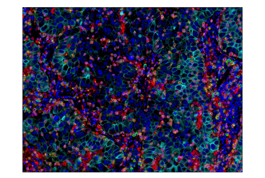 Immunohistochemistry Image 2: PD-1 (EH33) Mouse mAb (IHC-Specific) (BSA and Azide Free)