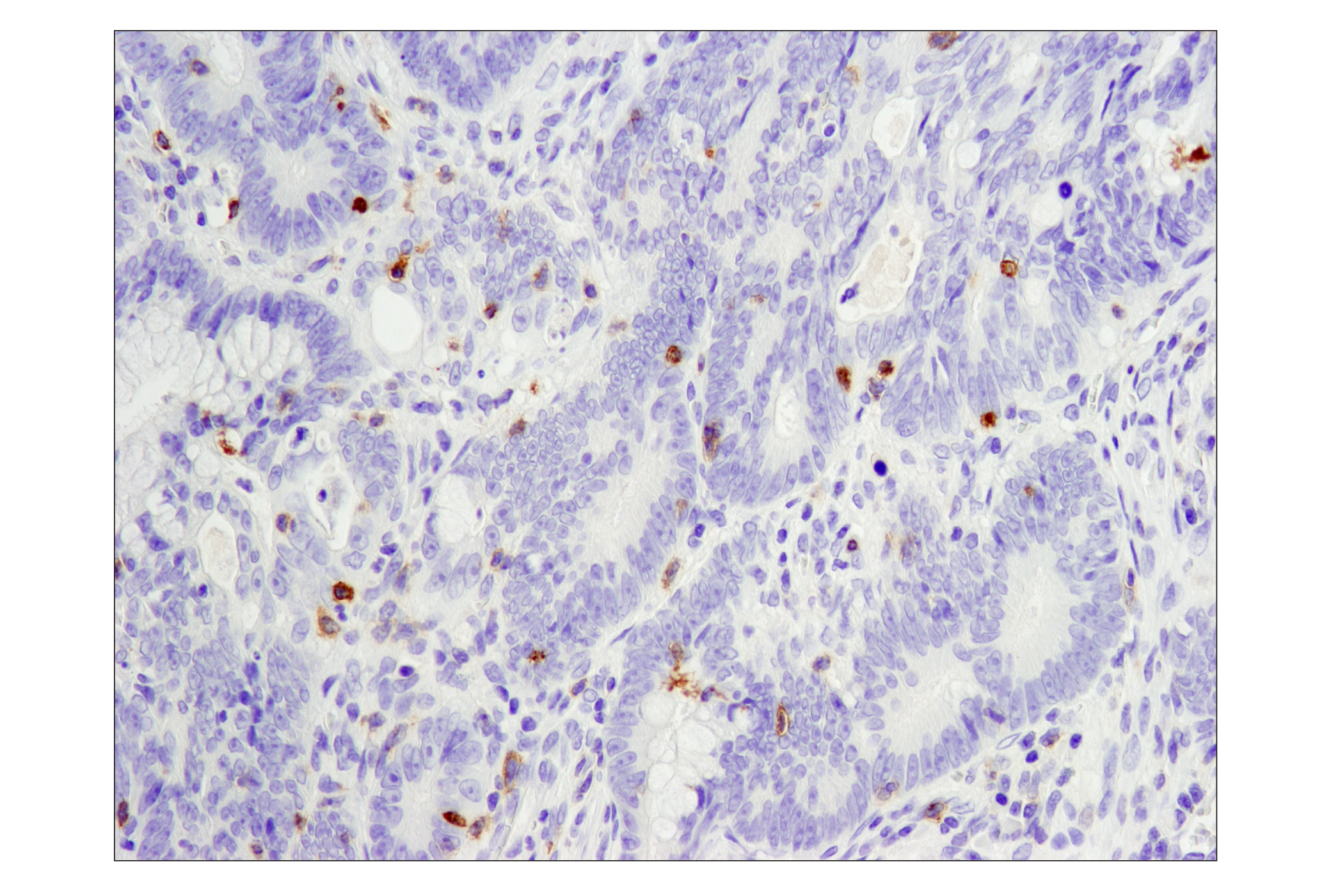 Immunohistochemistry Image 1: PD-1 (EH33) Mouse mAb (BSA and Azide Free)