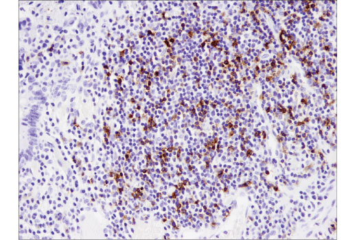 Immunohistochemistry Image 4: PD-1 (EH33) Mouse mAb (IHC-Specific) (BSA and Azide Free)