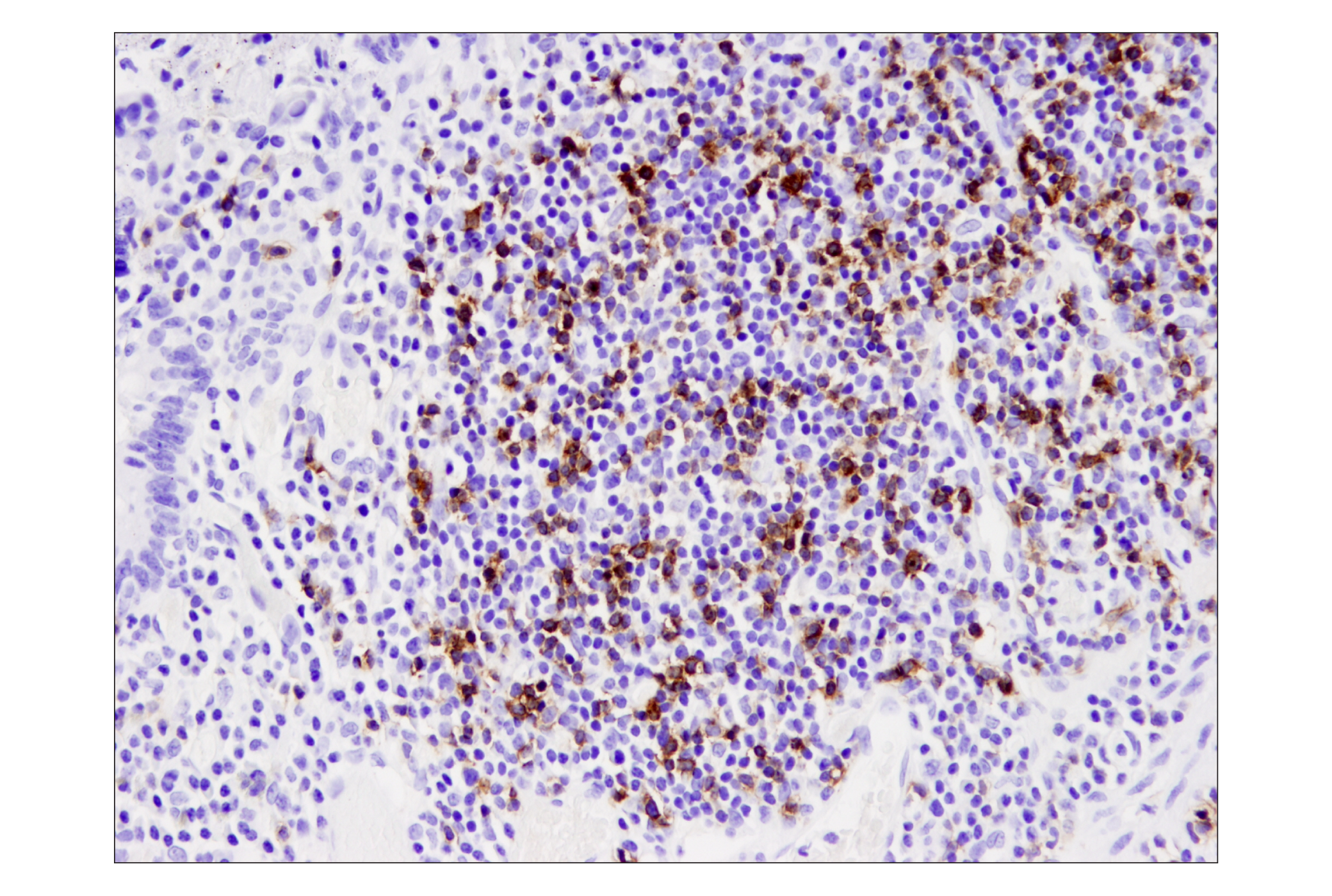 Immunohistochemistry Image 4: PD-1 (EH33) Mouse mAb (BSA and Azide Free)