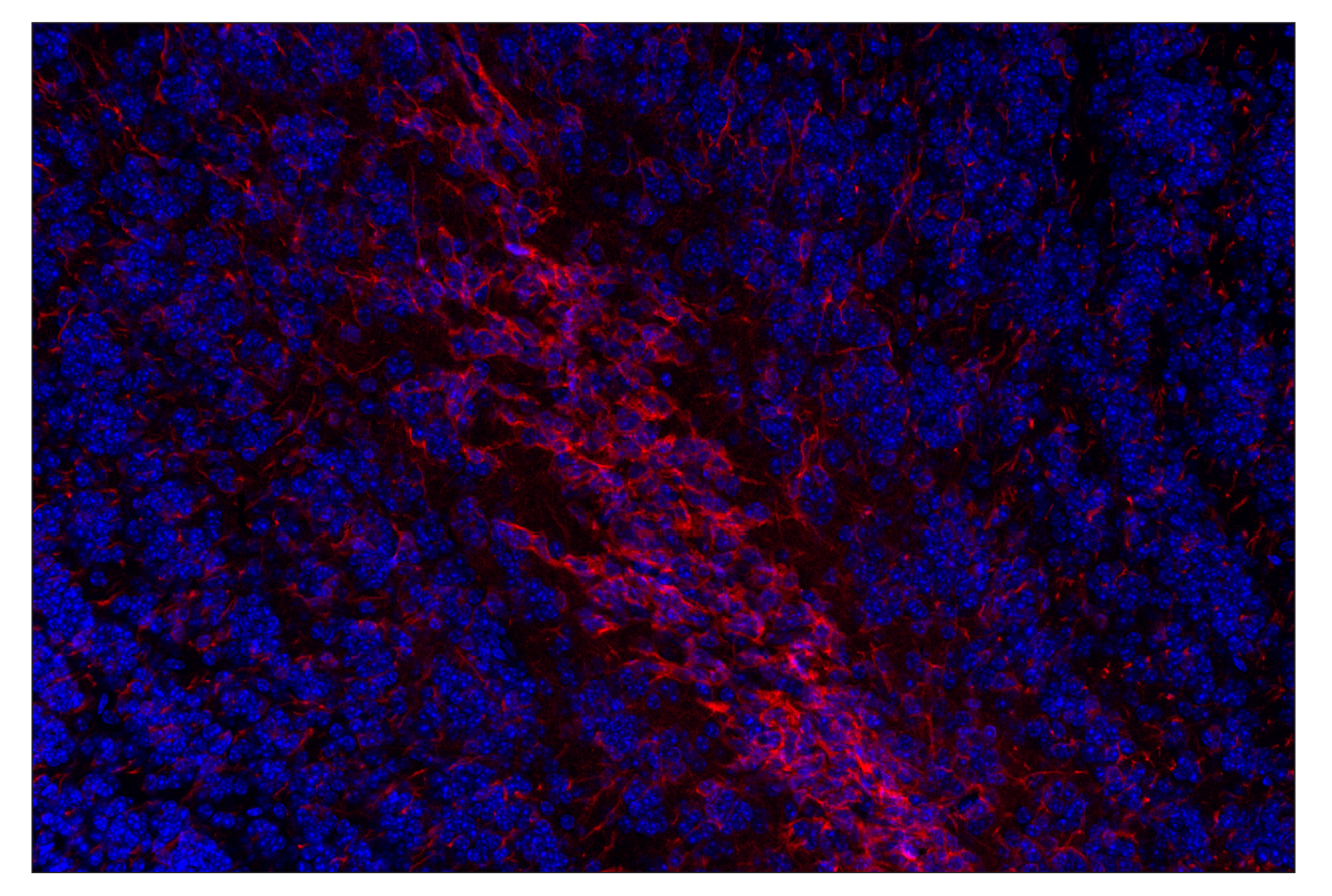 Immunohistochemistry Image 2: Doublecortin (E3S7L) Rabbit mAb (Alexa Fluor® 647 Conjugate)