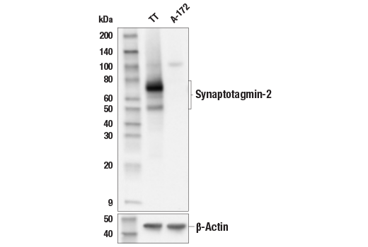 Western Blotting Image 2: Synaptotagmin-2 Antibody