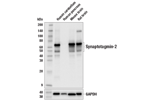 Western Blotting Image 1: Synaptotagmin-2 Antibody