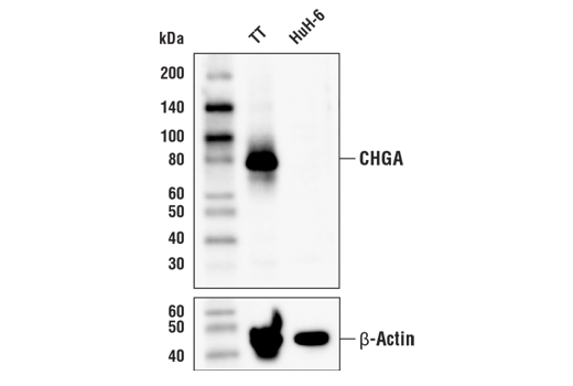 Western Blotting Image 1: CHGA Antibody
