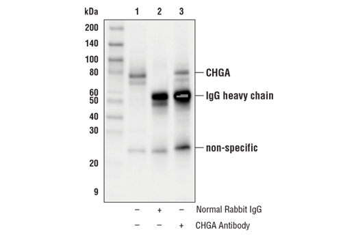Immunoprecipitation Image 1: CHGA Antibody