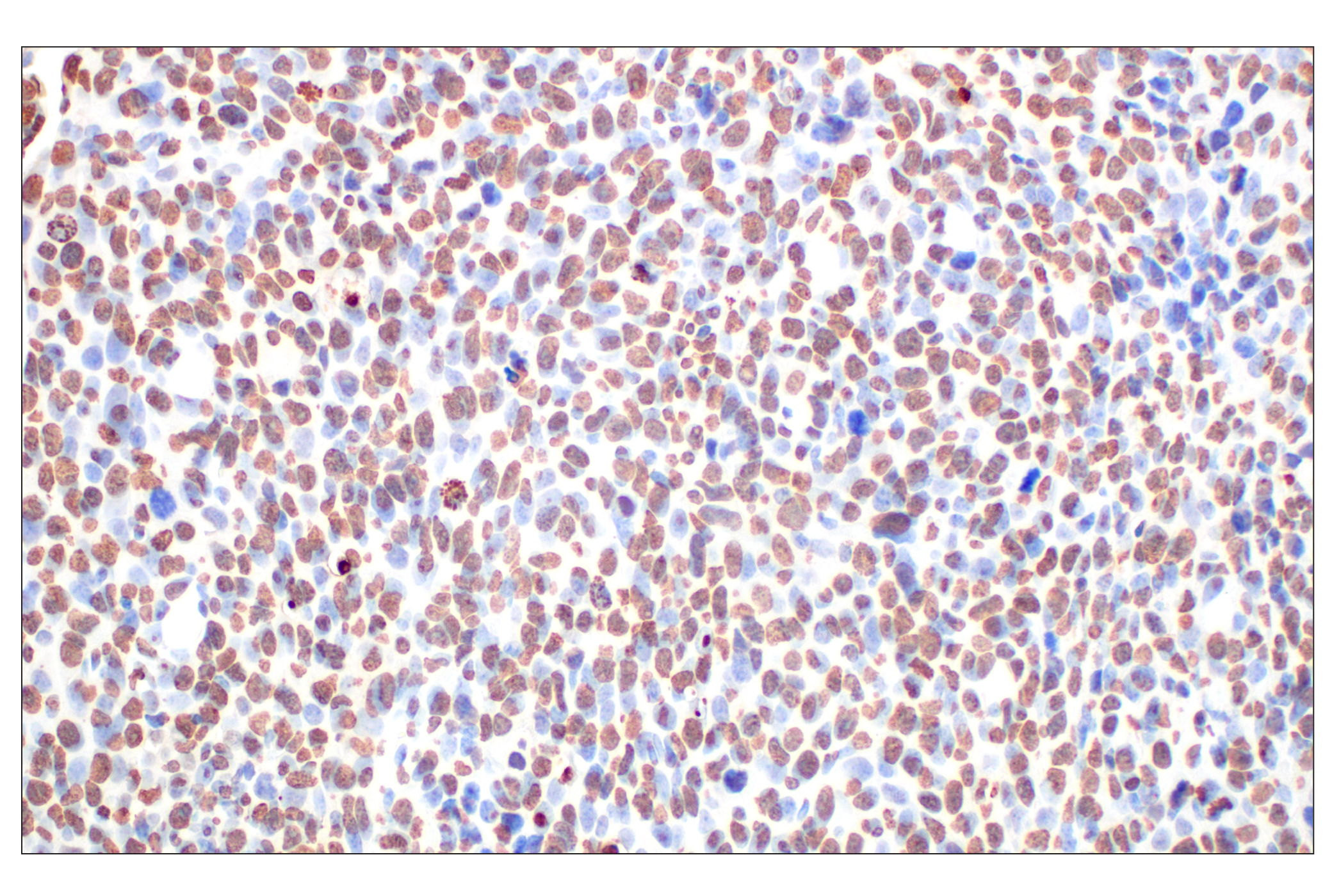 Immunohistochemistry Image 3: Histone H3 (D1H2) XP® Rabbit mAb (BSA and Azide Free)