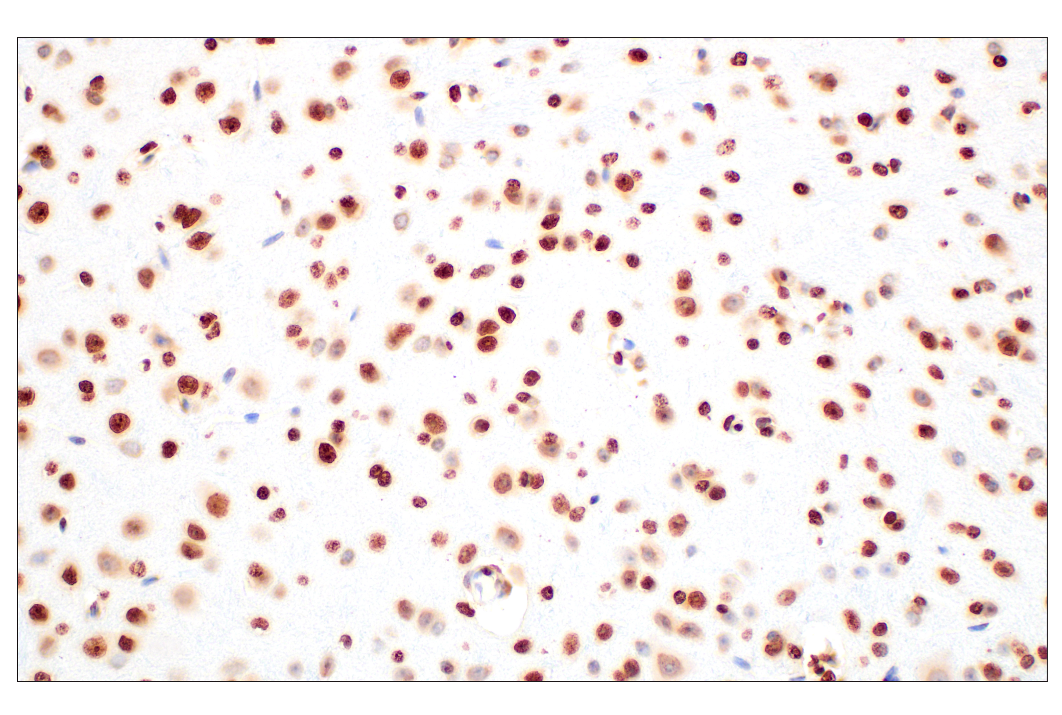 Immunohistochemistry Image 4: Histone H3 (D1H2) XP® Rabbit mAb (BSA and Azide Free)