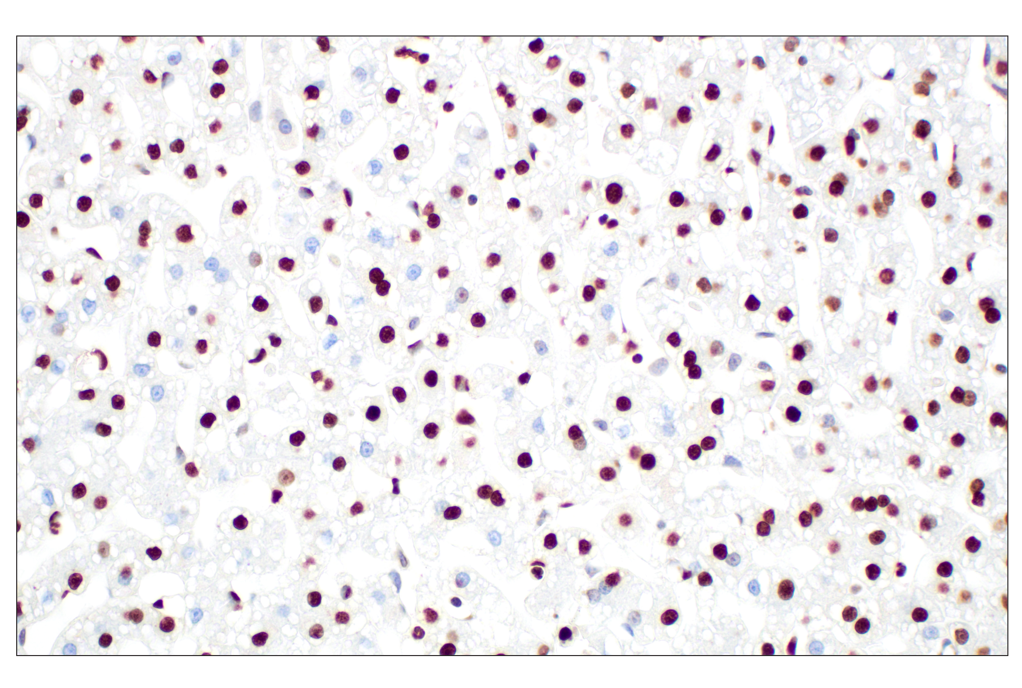 Immunohistochemistry Image 5: Histone H3 (D1H2) XP® Rabbit mAb (BSA and Azide Free)