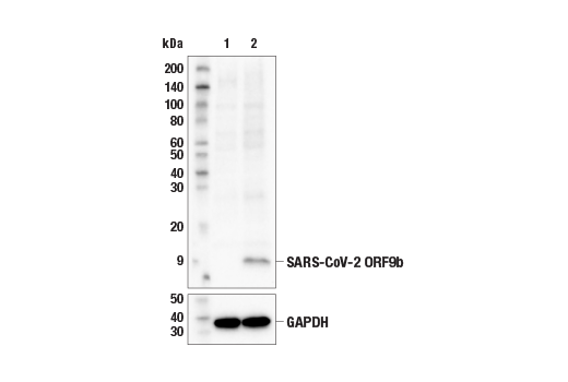 Western Blotting Image 1: SARS-CoV-2 ORF9b Antibody
