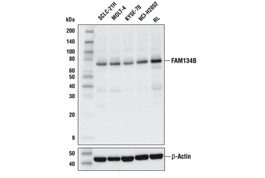 Western Blotting Image 2: FAM134B Antibody