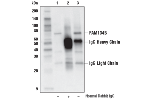 Immunoprecipitation Image 1: FAM134B Antibody