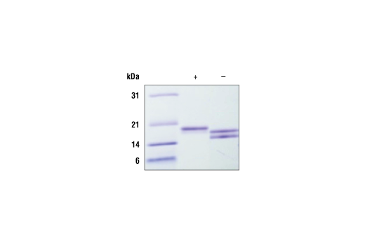  Image 1: Human IL-33 Recombinant Protein