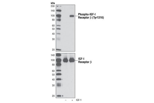 Western Blotting Image 1: Phospho-IGF-I Receptor β (Tyr1316) Antibody