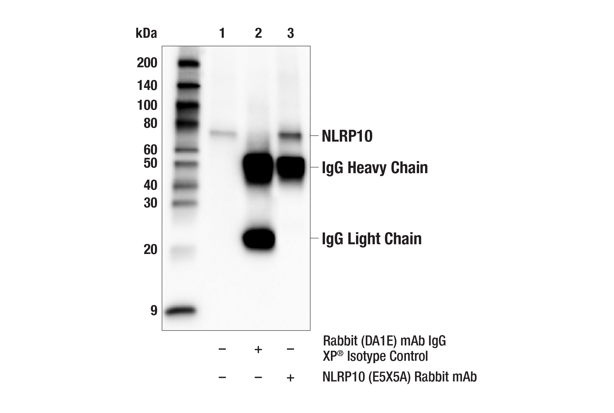 Immunoprecipitation Image 1: NLRP10 (E5X5A) Rabbit mAb