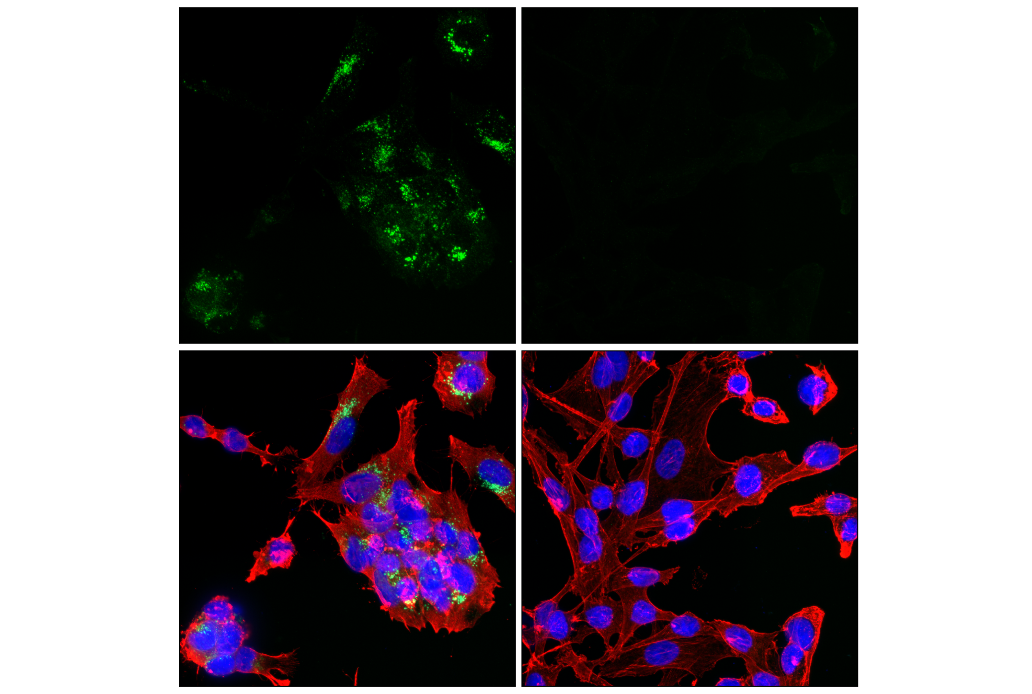 Immunofluorescence Image 1: GPR64 (E9D4X) Rabbit mAb