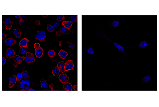 Immunofluorescence Image 2: PD-1 (Intracellular Domain) (D7D5W) XP® Rabbit mAb (Alexa Fluor® 647 Conjugate)