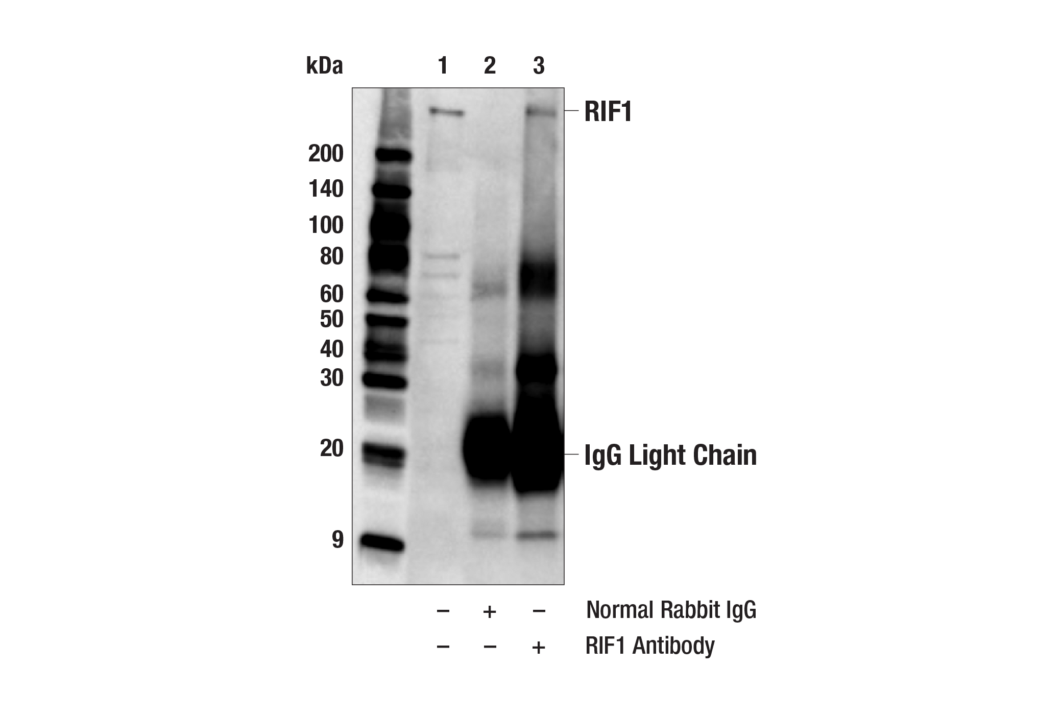 Immunoprecipitation Image 1: RIF1 Antibody