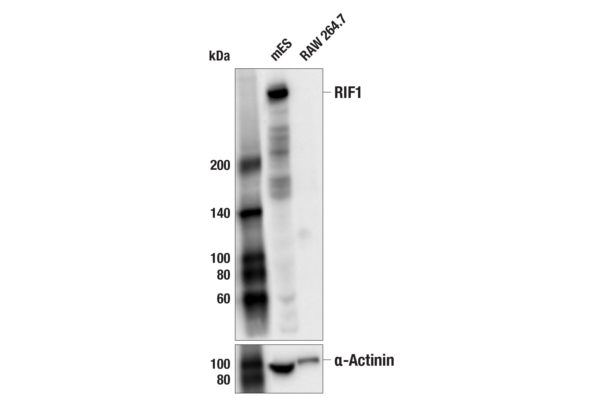 Western Blotting Image 1: RIF1 Antibody